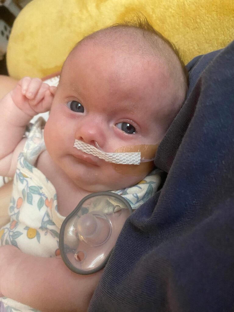 Children with Trisomy 18