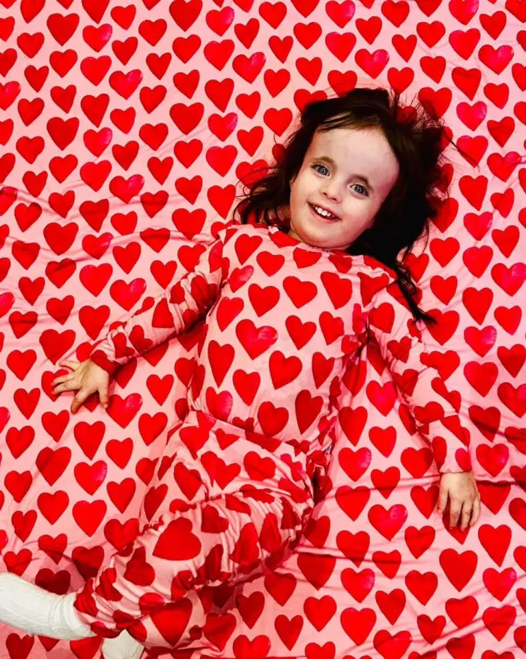 Children with Trisomy 18