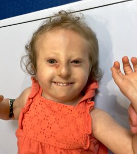 Adelyn, Full Trisomy 18, Thriving Thursday Child