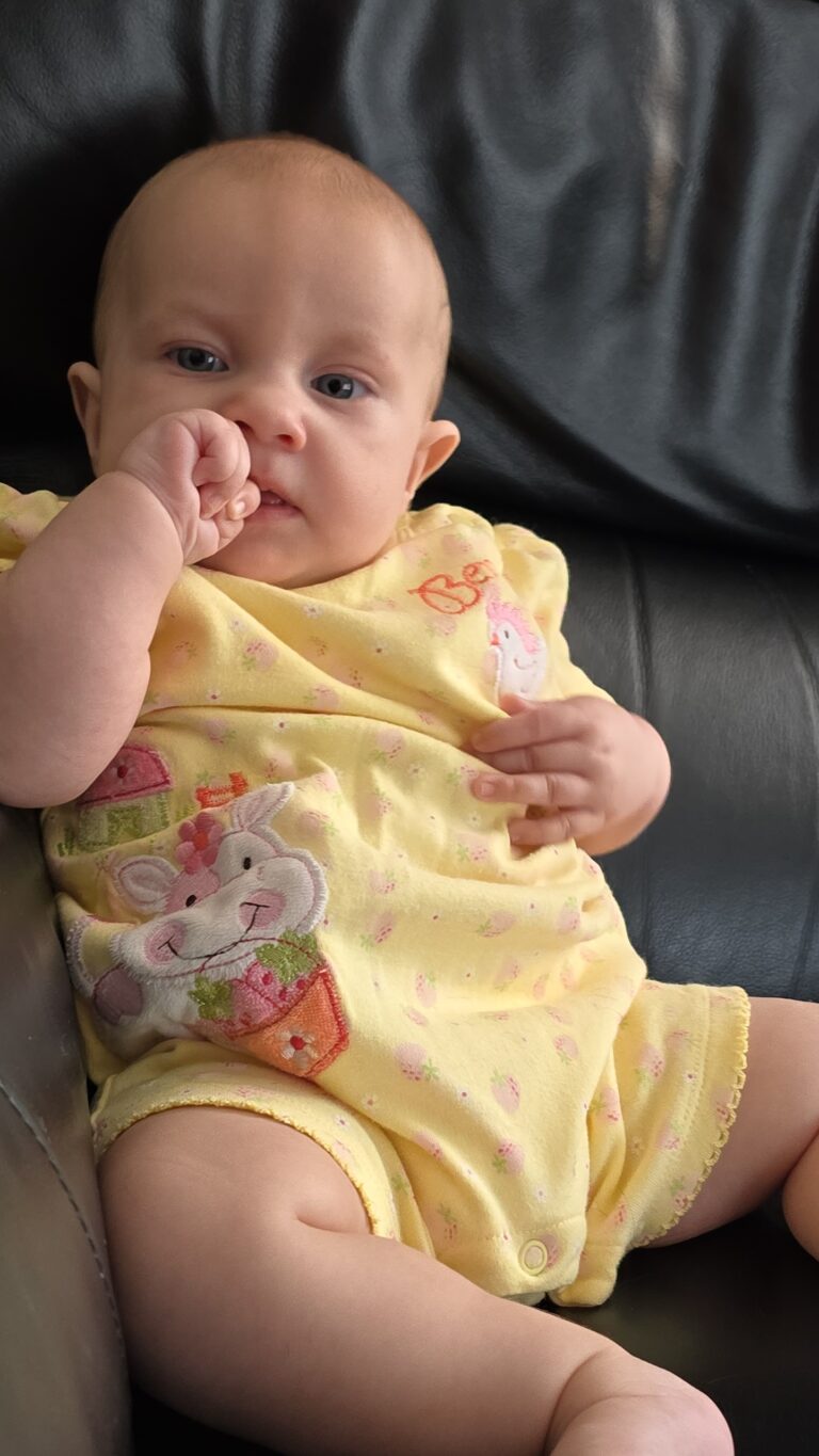 Ariella. Mosaic Trisomy 18. Thriving Thursday Child