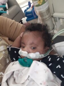 Raphtalia, Full Trisomy 18, Thriving Thursday Child