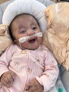 Trisomy 18 Infant in pink clothing, relaxed position.